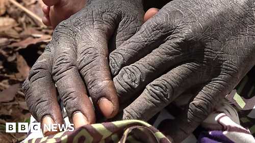 Zambia on the brink of famine