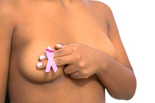 When You Know You Know: Today, Take 5 Minutes to Assess Your Breast and Ovarian Cancer Risk