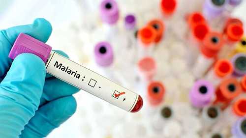 Ugandan Creates Device To Detect Malaria